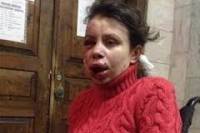 На сайте Белого Дома появилась петиция о реакции США на избиение Черновол